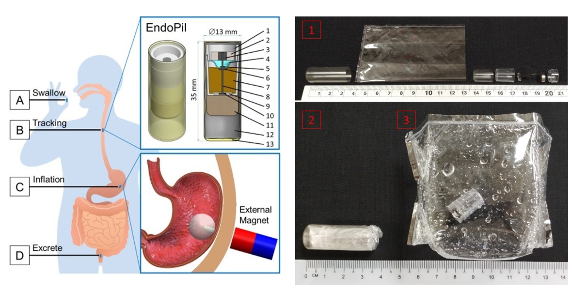 Magnet-actuated capsule for Weight Management