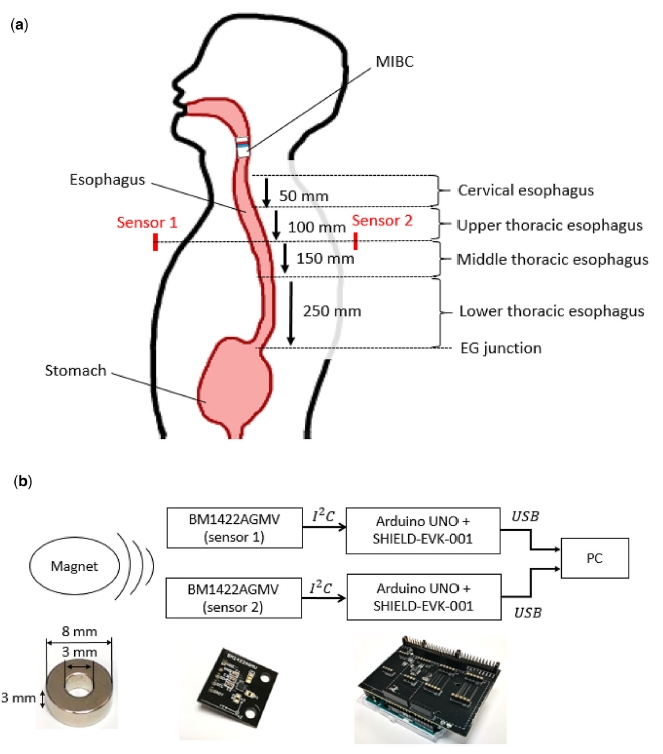 Two Magnetic Sensor Based Real-Time Tracking of Magnetically Inflated Swallowable Intragastric Balloon